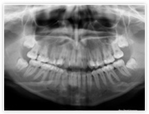 いとう歯科クリニックではデジタルレントゲンシステムを導入しております。